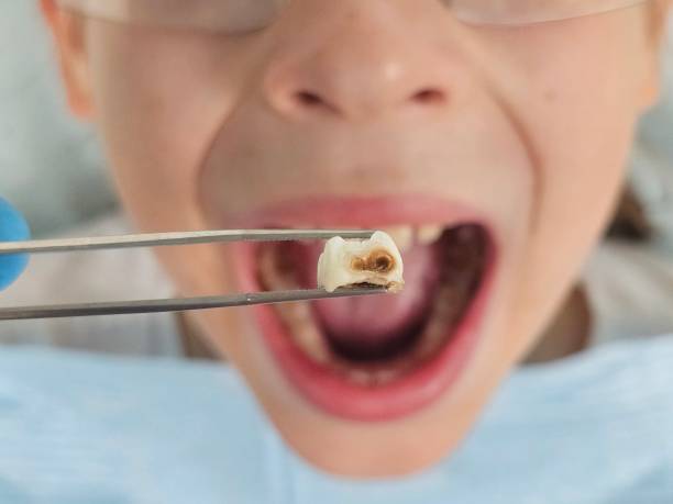 Best Emergency Orthodontic Repairs in Acworth, GA
