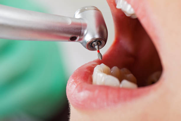 Best Pediatric Emergency Dentist in Acworth, GA